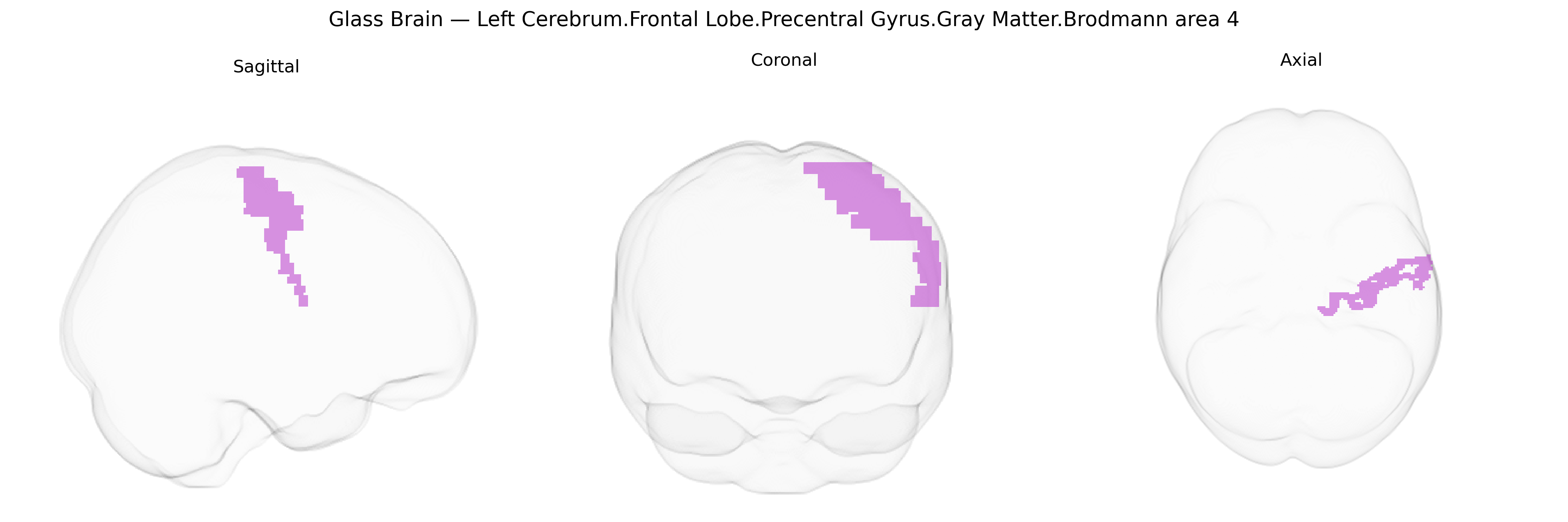 Triplanar Ghost Brain