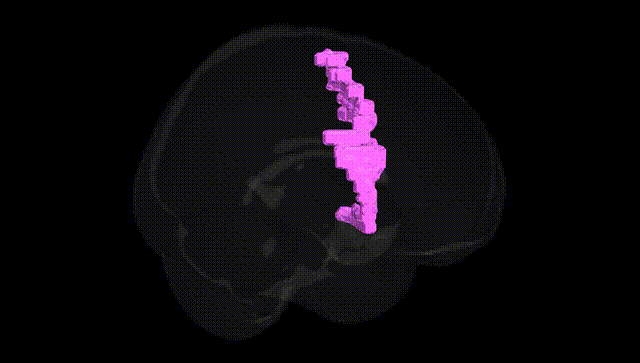 Full Brain Black