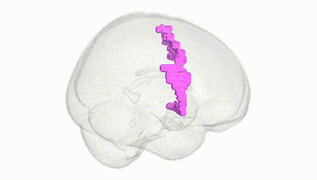 Full Brain White