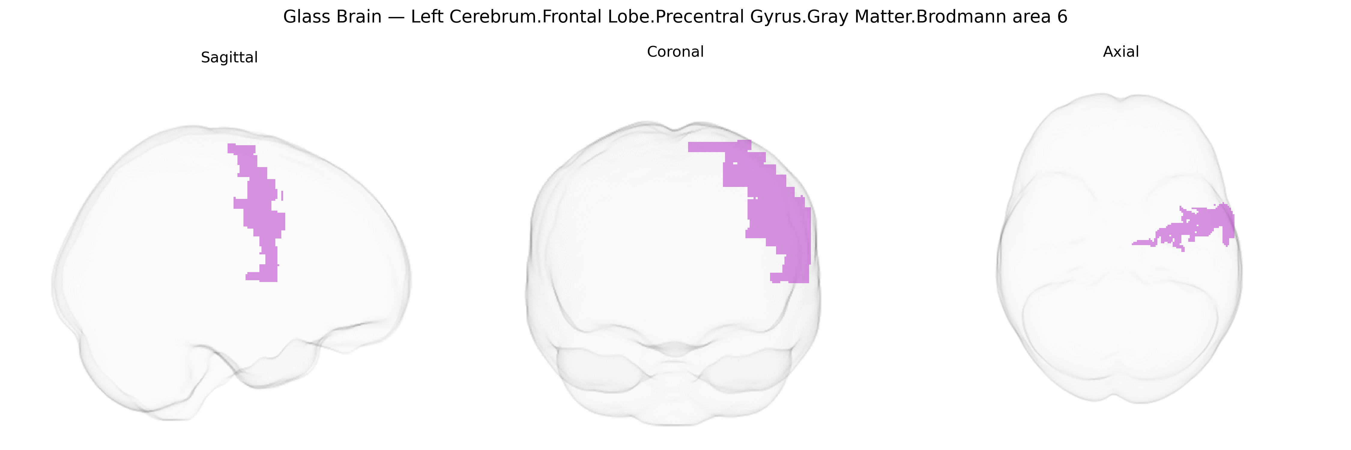 Triplanar Ghost Brain