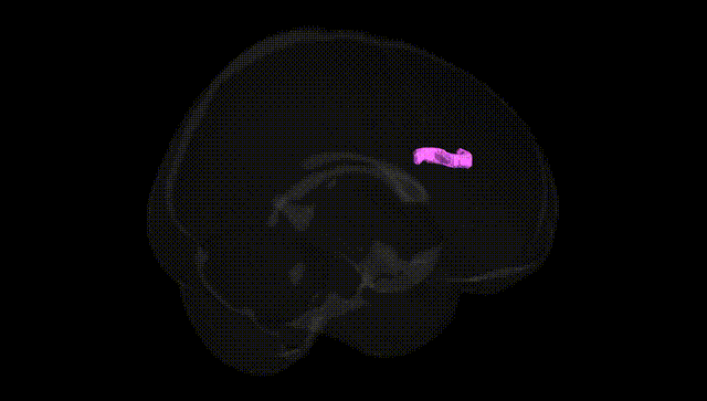 Full Brain Black