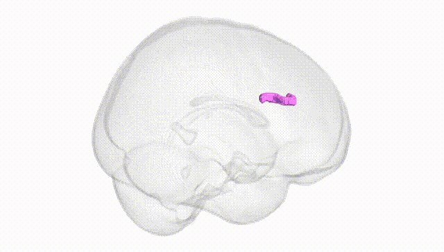 Full Brain White