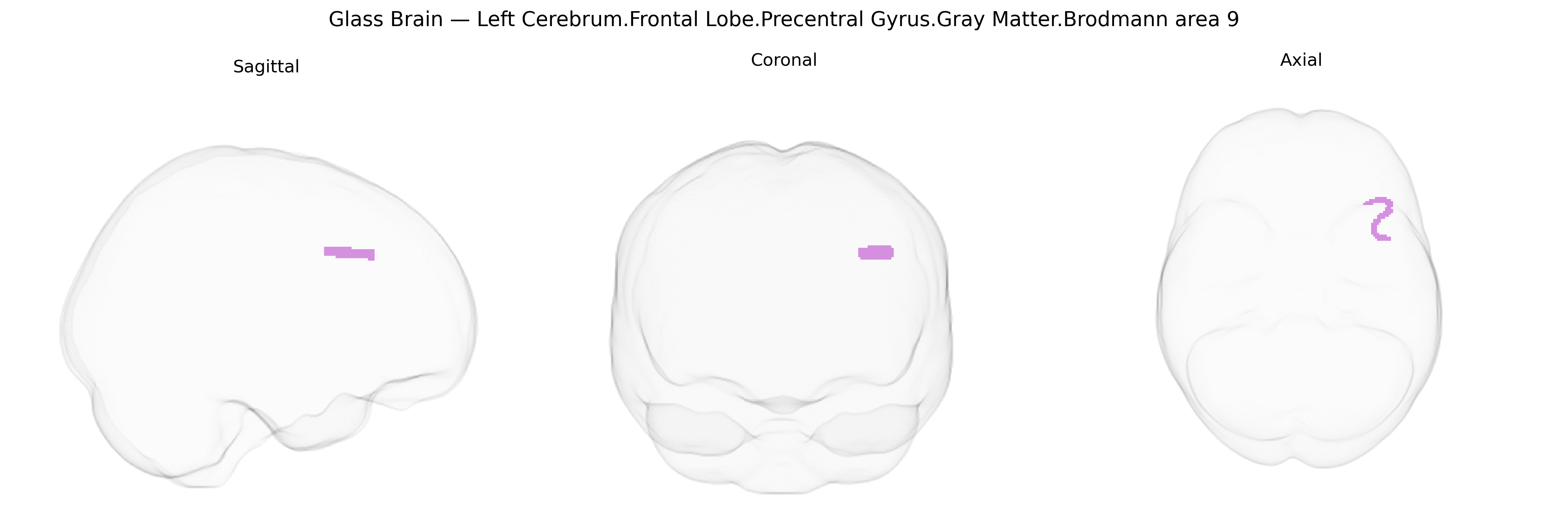 Triplanar Ghost Brain