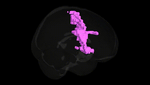 Full Brain Black