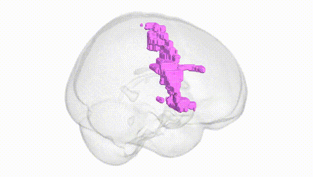 Full Brain White