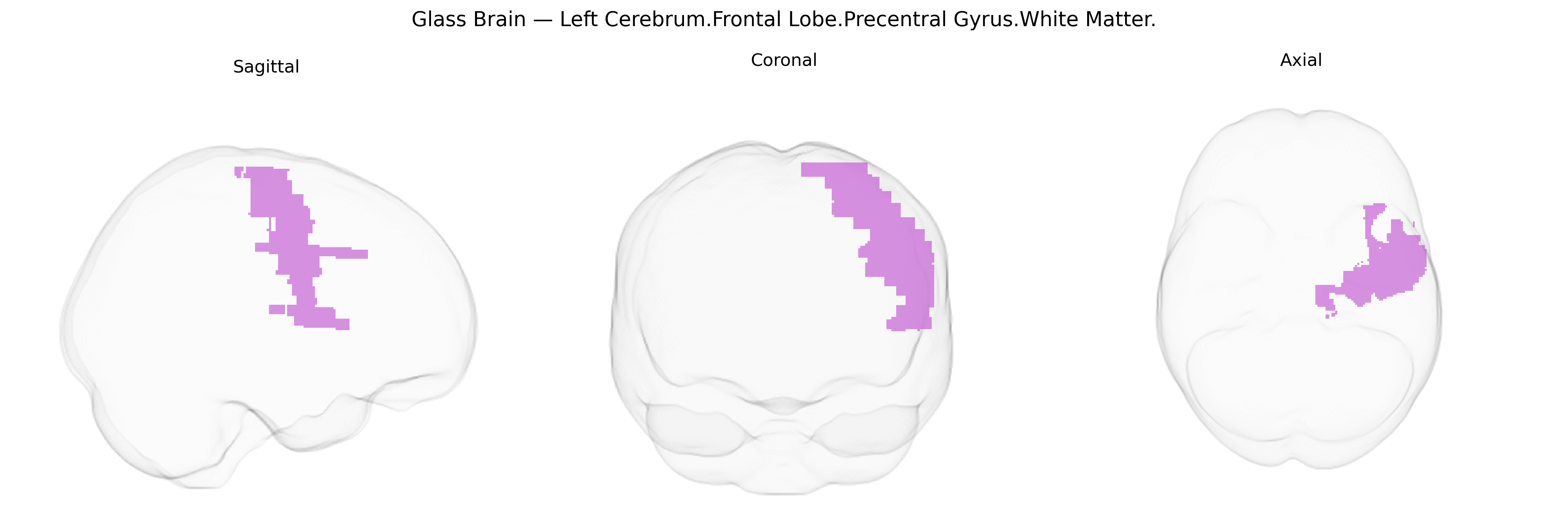 Triplanar Ghost Brain