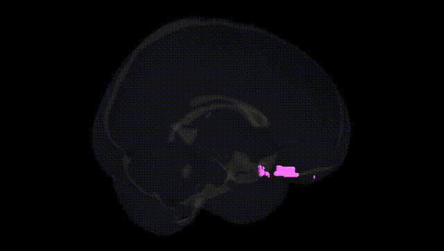 Full Brain Black