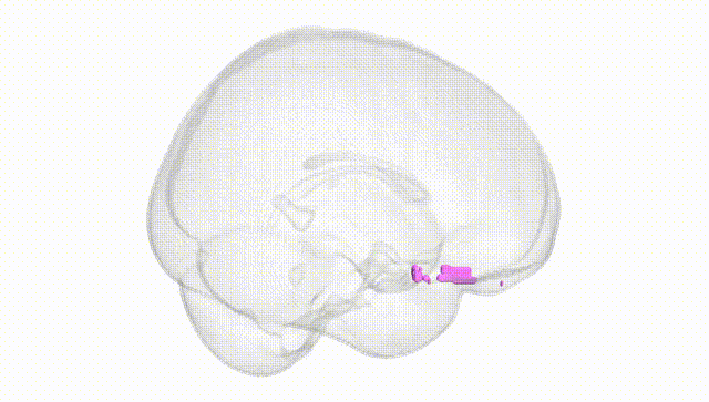 Full Brain White