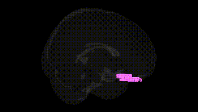 Full Brain Black