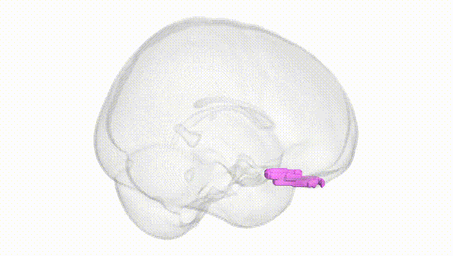 Full Brain White