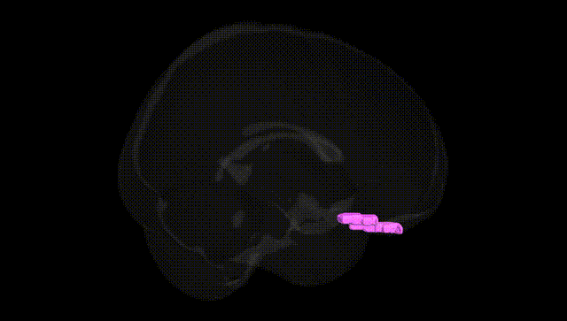 Full Brain Black