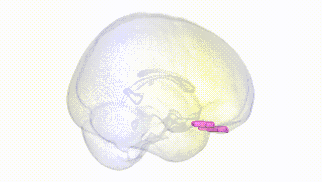 Full Brain White