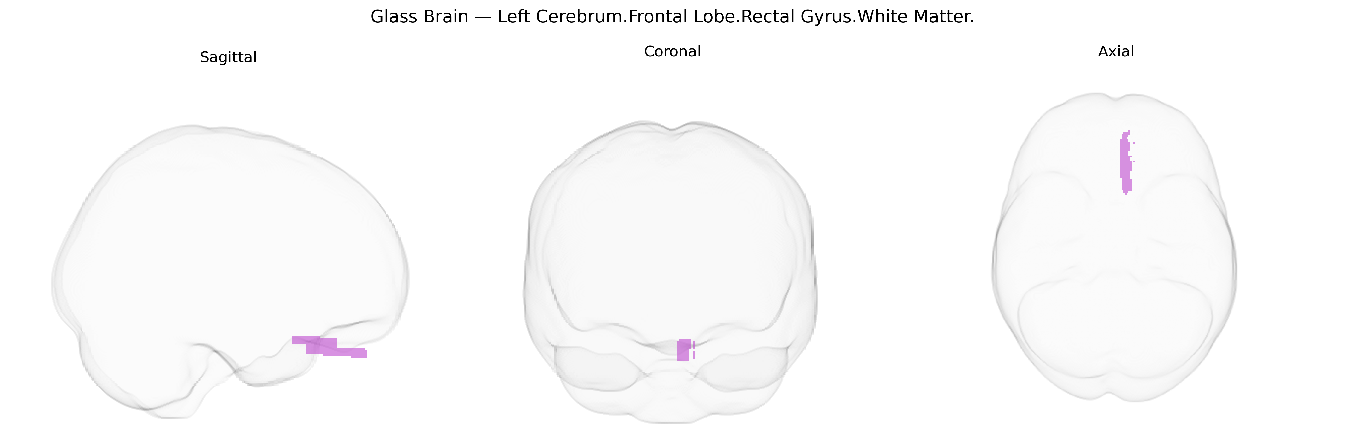 Triplanar Ghost Brain