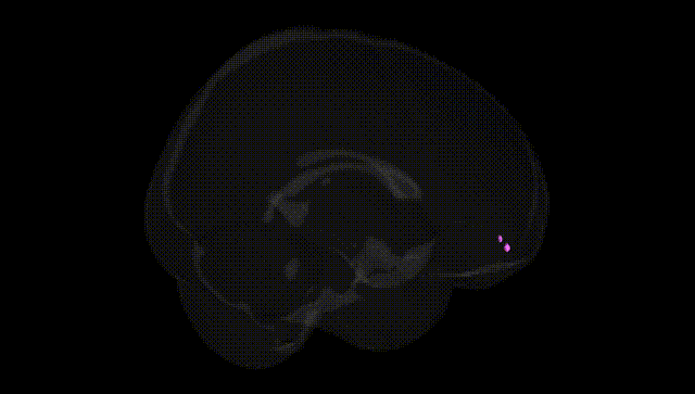 Full Brain Black