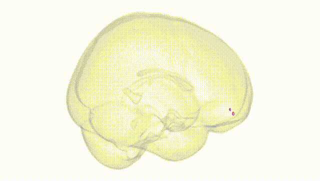 Full Brain White