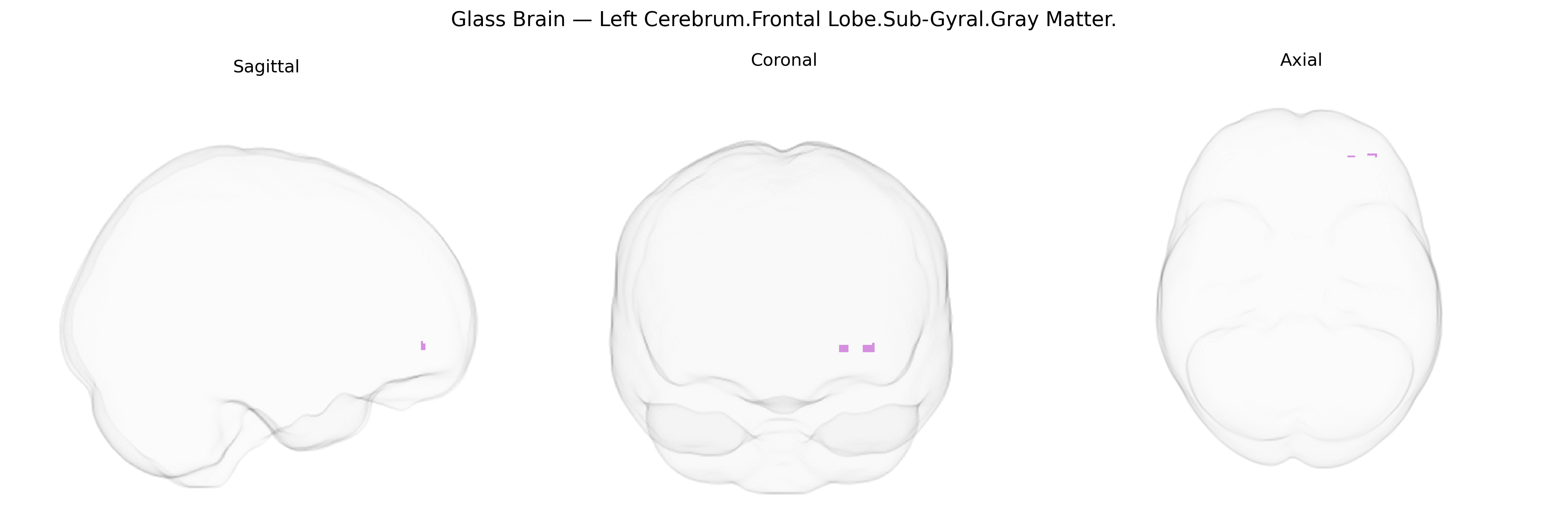 Triplanar Ghost Brain
