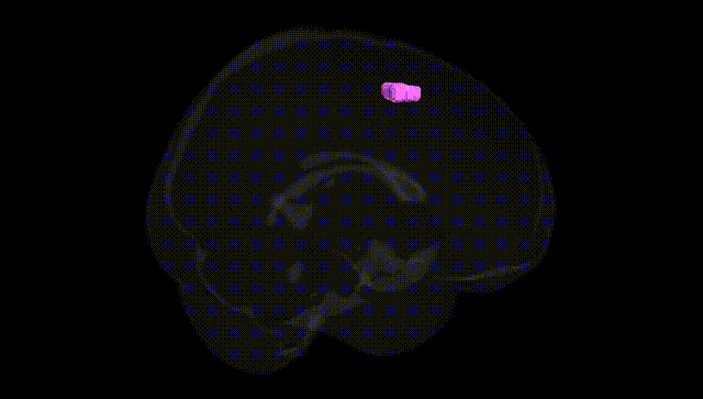 Full Brain Black