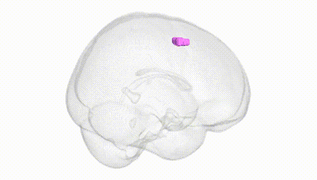 Full Brain White
