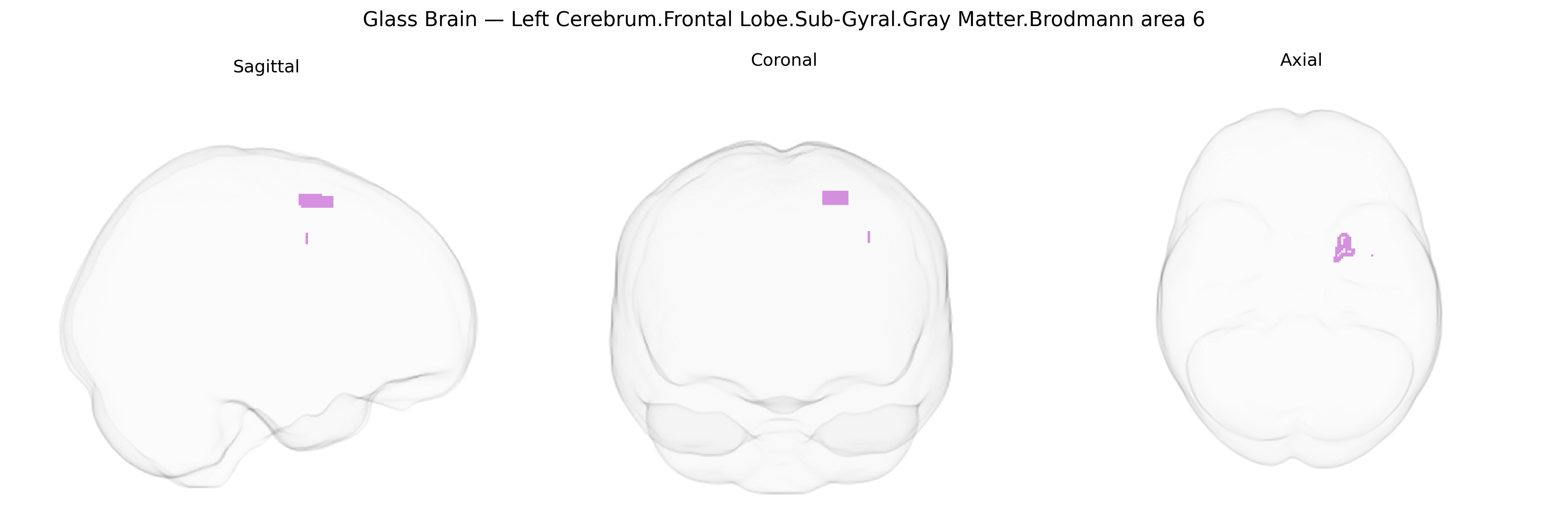 Triplanar Ghost Brain