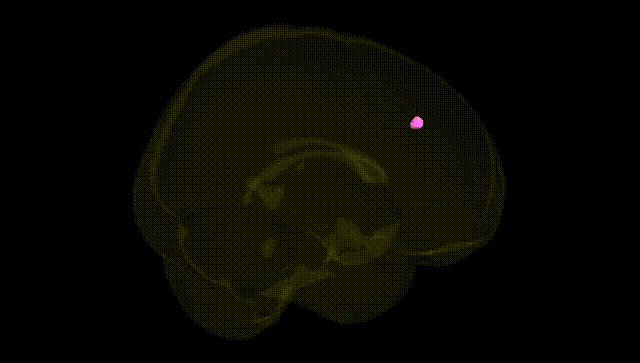 Full Brain Black