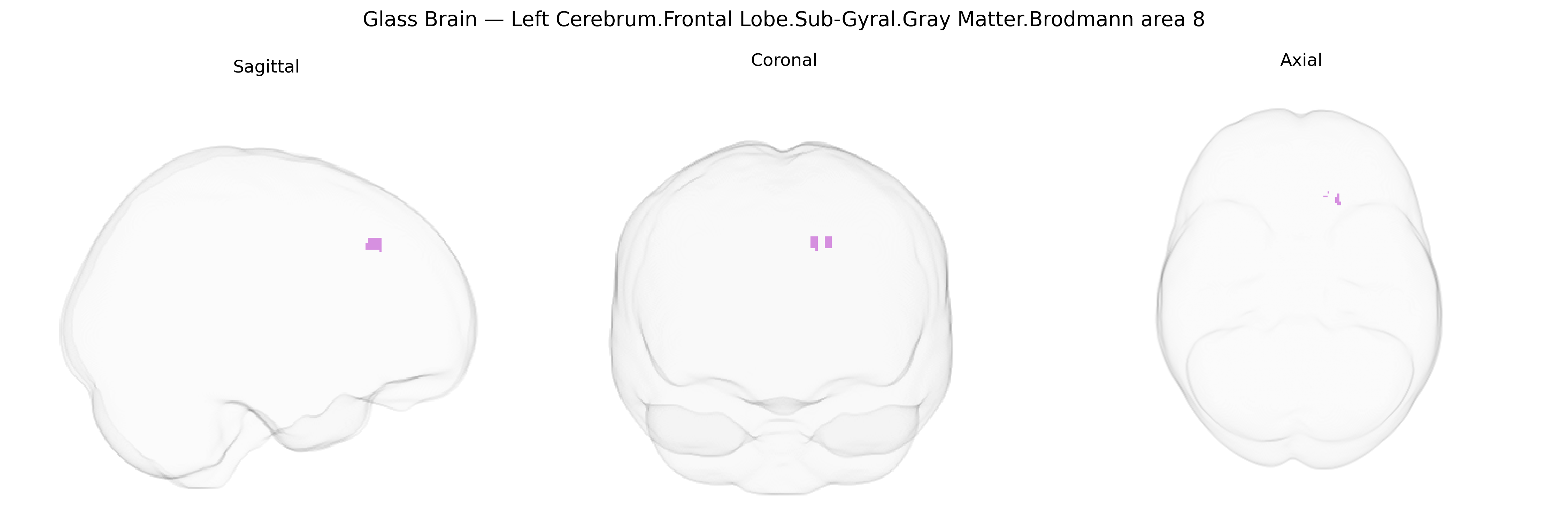 Triplanar Ghost Brain