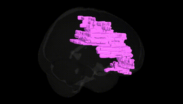 Full Brain Black