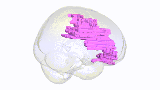Full Brain White