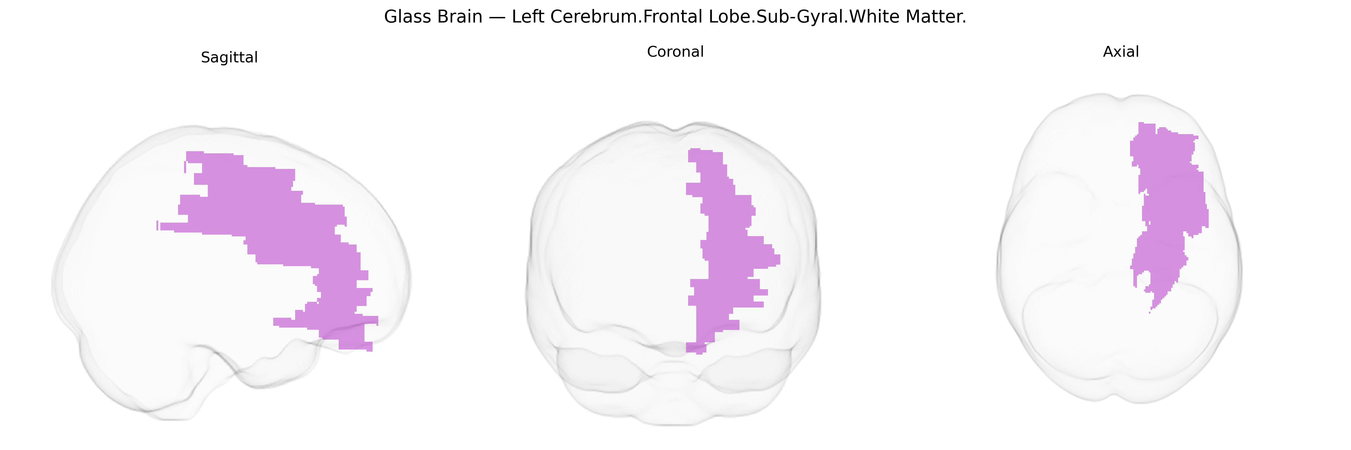 Triplanar Ghost Brain