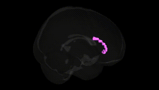 Full Brain Black