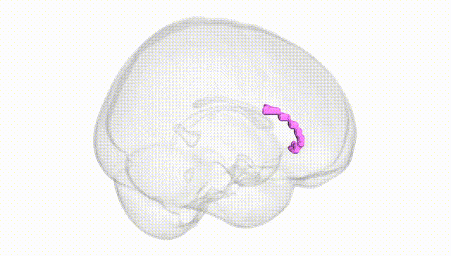 Full Brain White