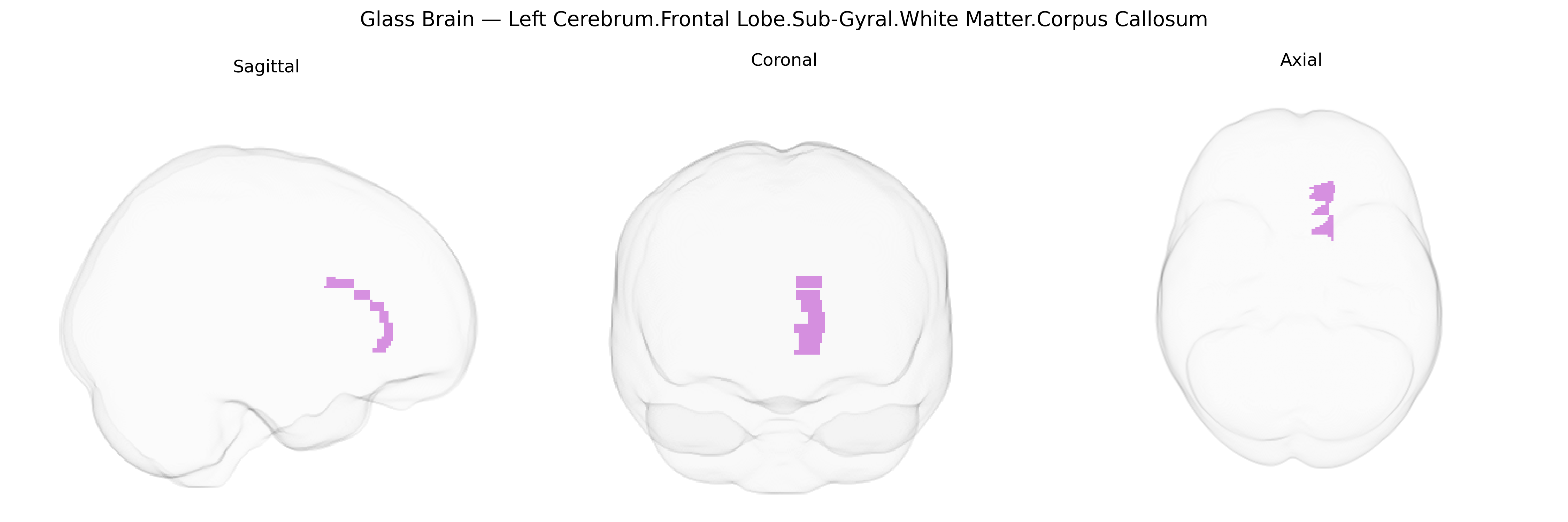 Triplanar Ghost Brain