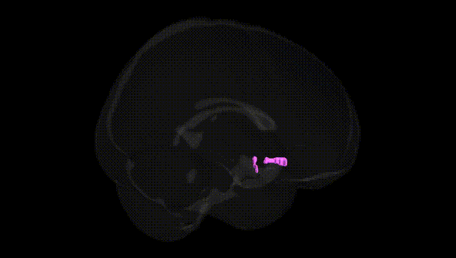 Full Brain Black