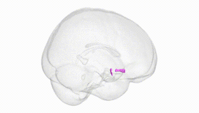 Full Brain White