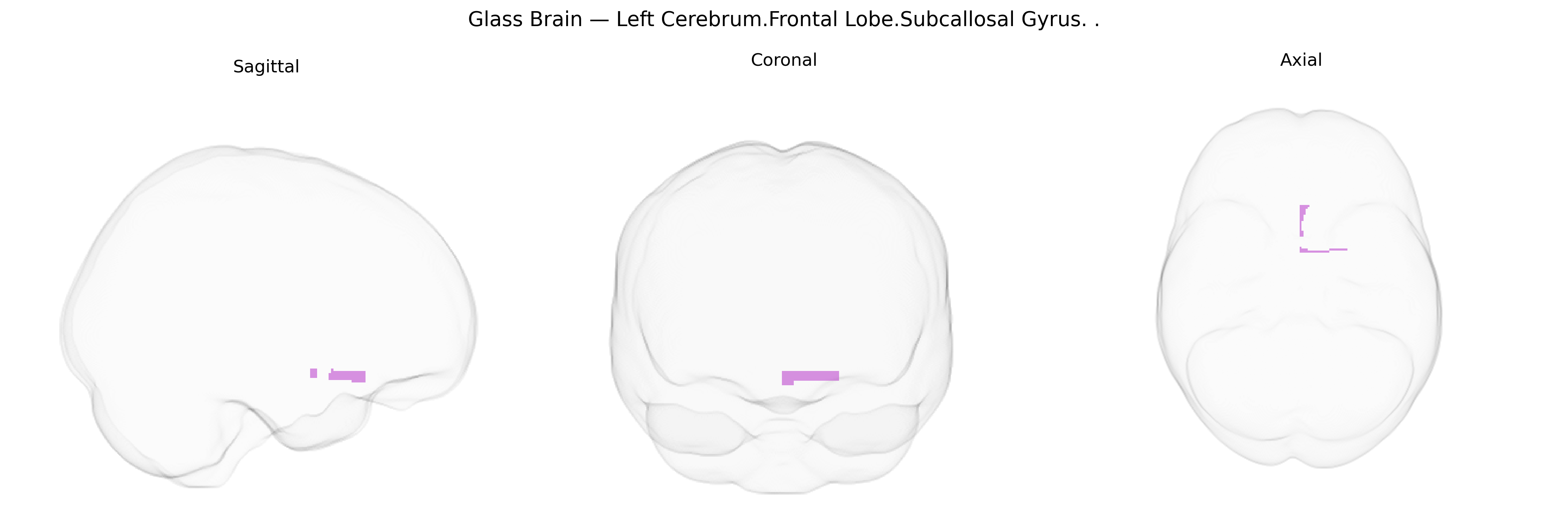 Triplanar Ghost Brain