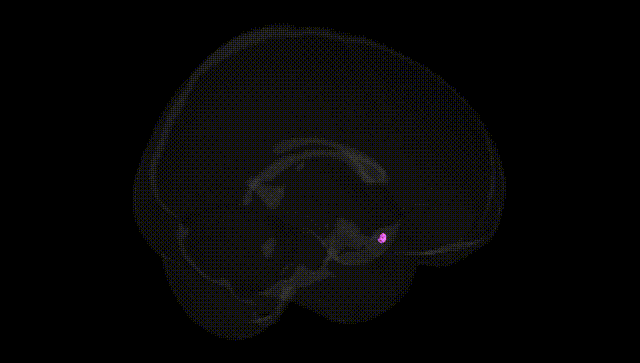 Full Brain Black