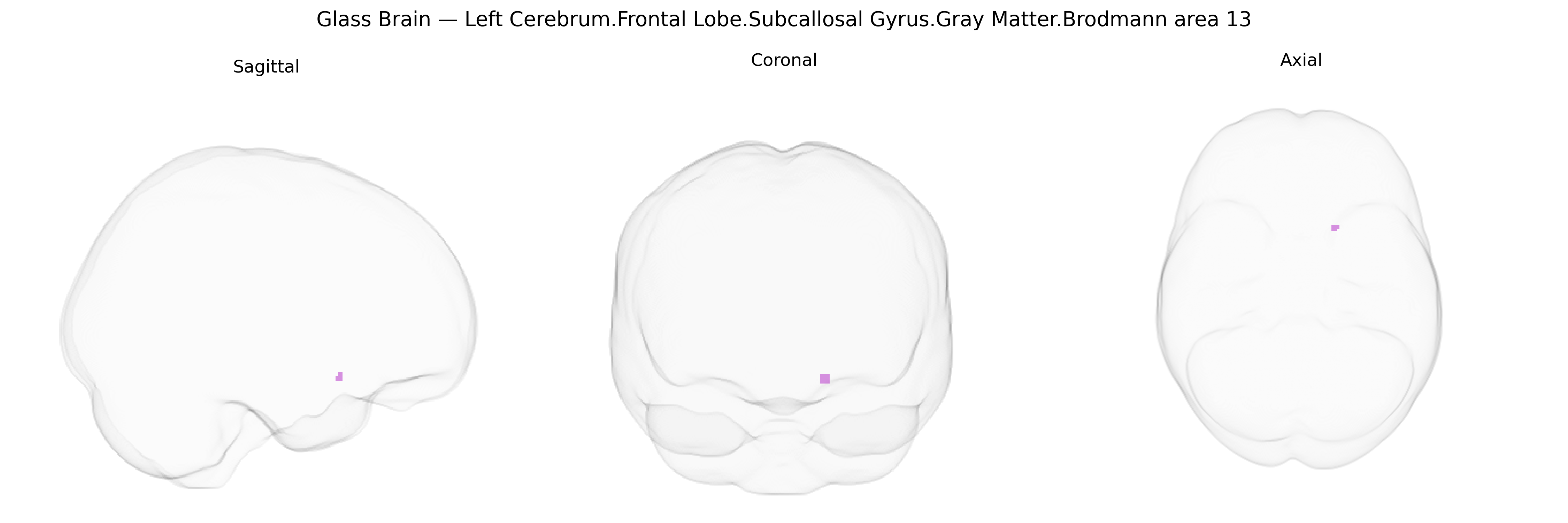 Triplanar Ghost Brain