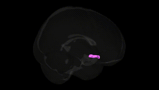 Full Brain Black