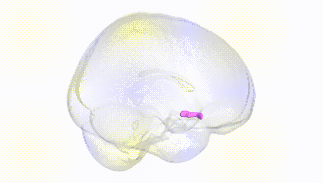 Full Brain White