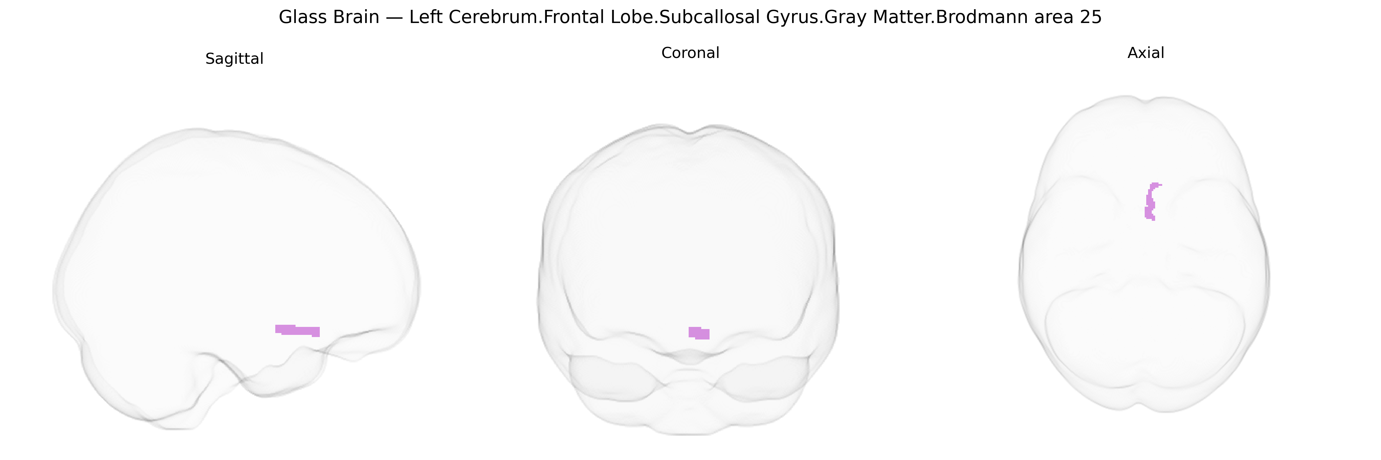 Triplanar Ghost Brain