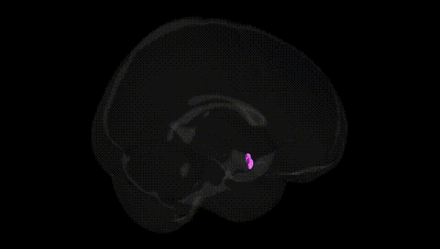 Full Brain Black