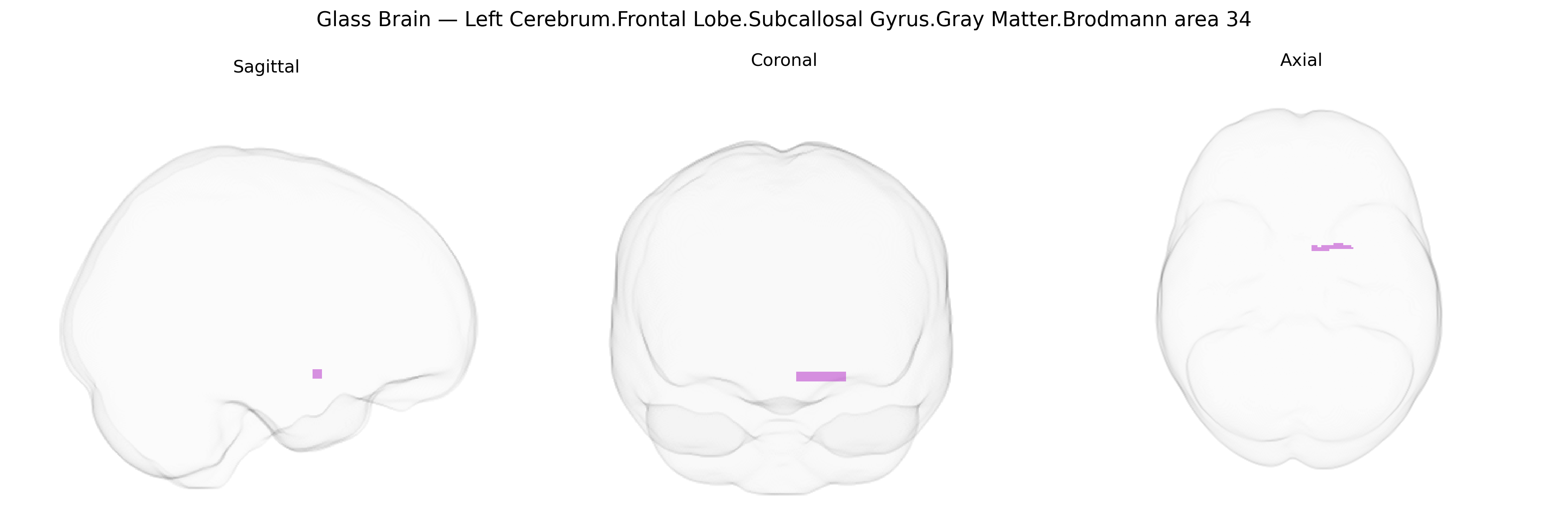 Triplanar Ghost Brain