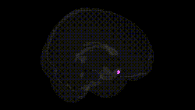 Full Brain Black