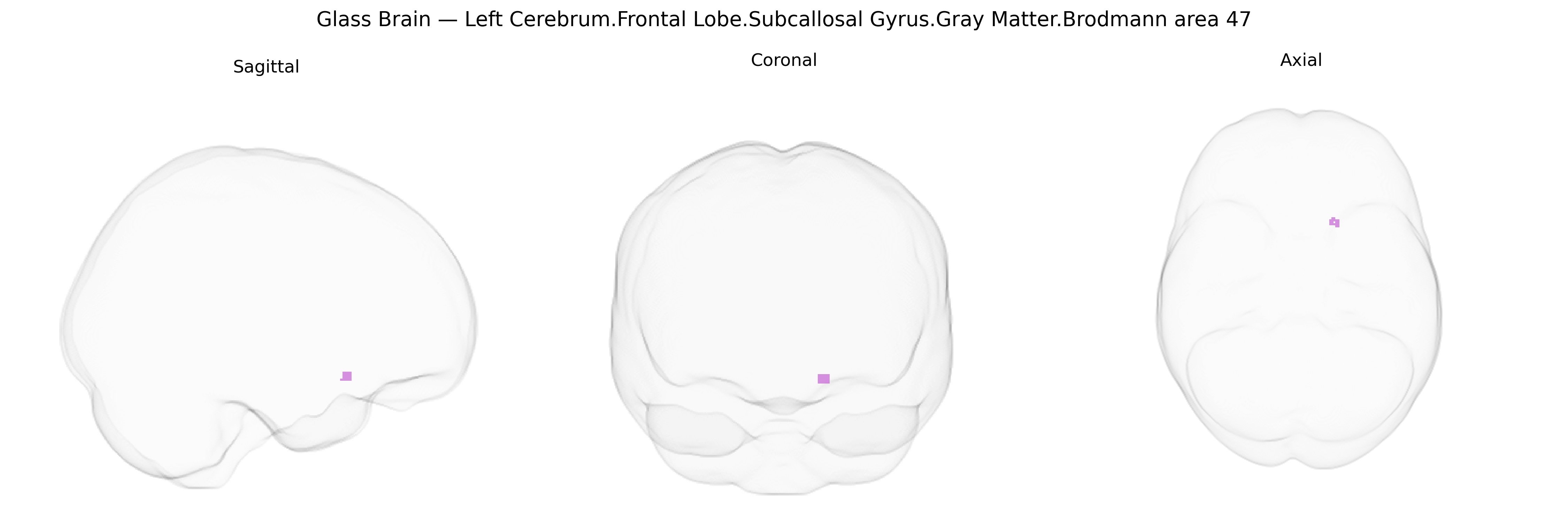 Triplanar Ghost Brain