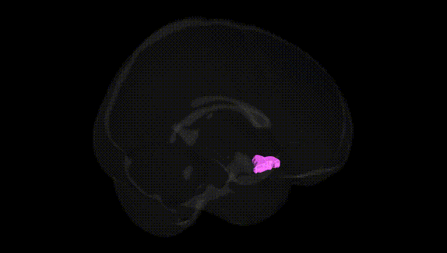 Full Brain Black