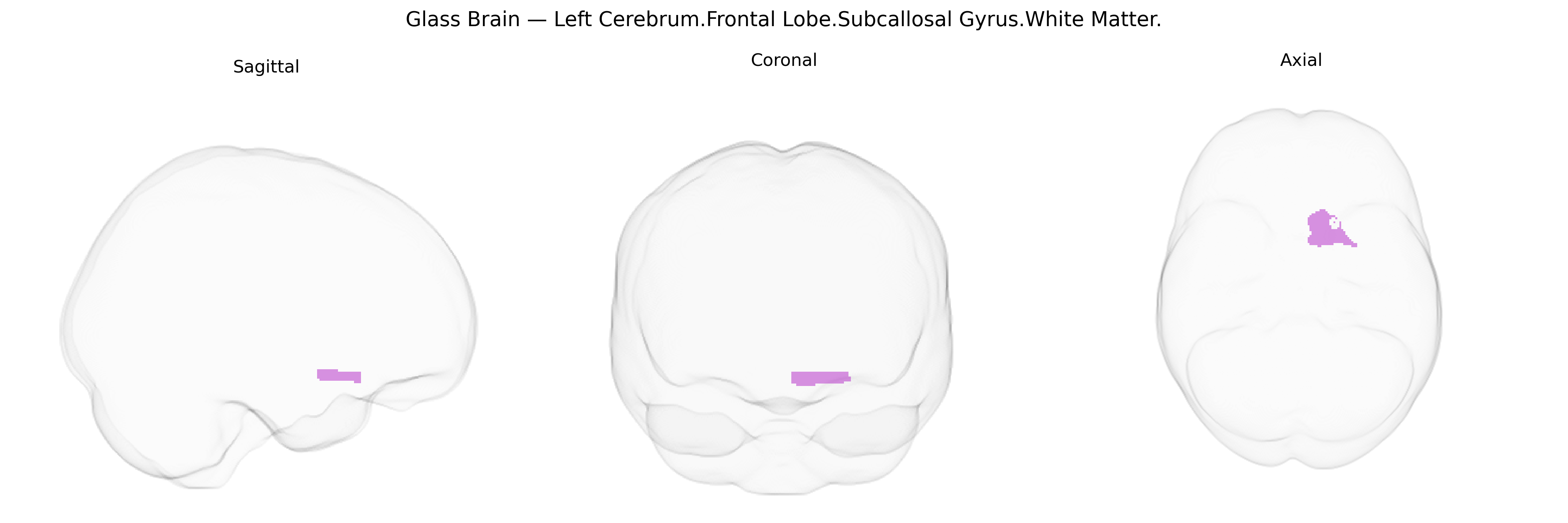 Triplanar Ghost Brain