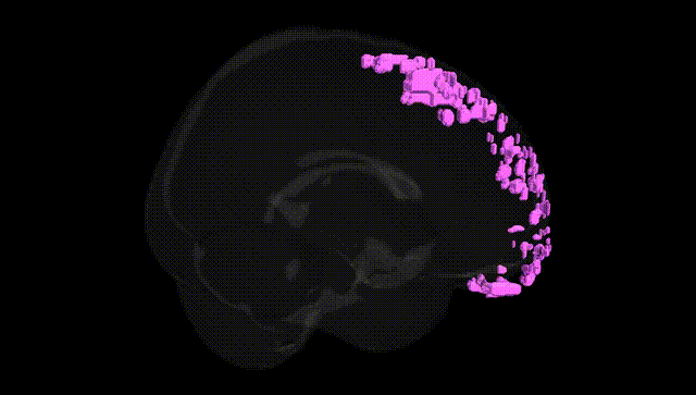 Full Brain Black