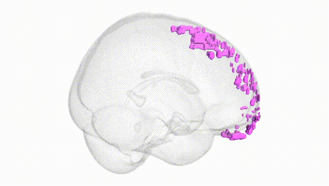 Full Brain White