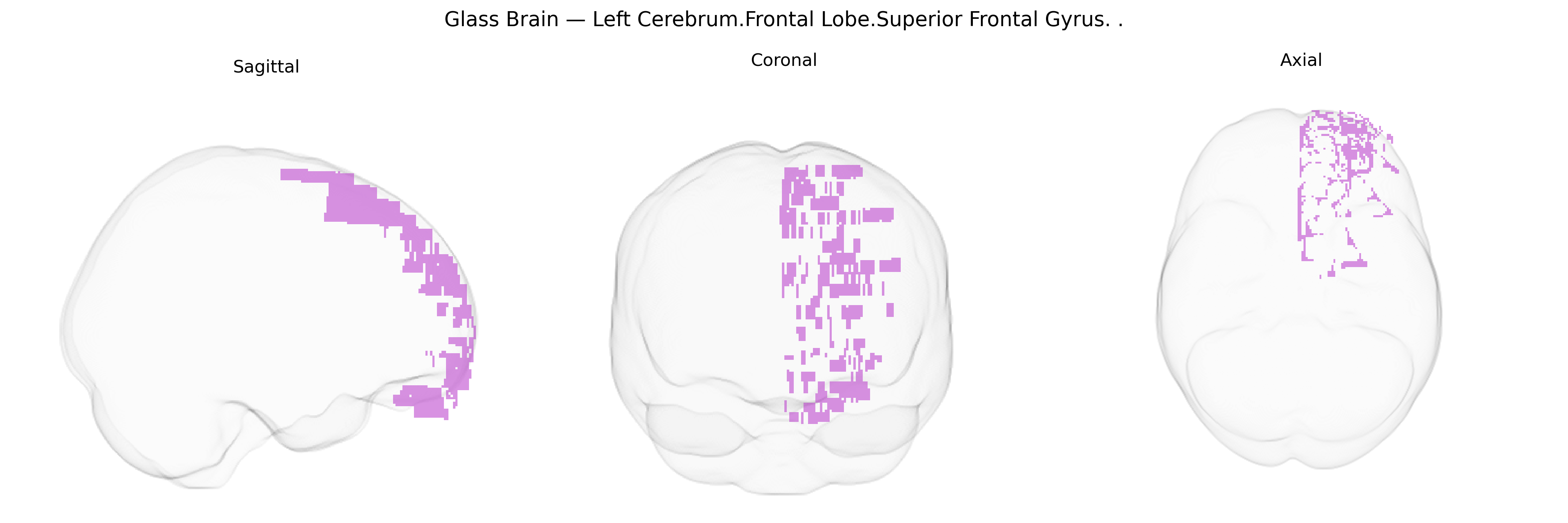Triplanar Ghost Brain