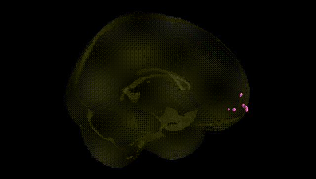 Full Brain Black