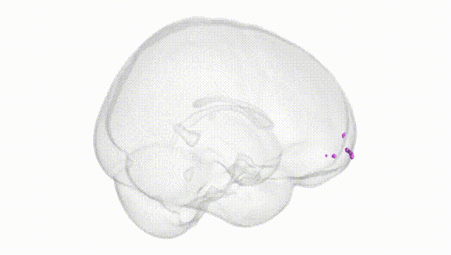 Full Brain White
